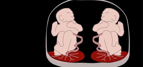 Tumore alle ovaie salvata giovane mamma e i suoi gemellini