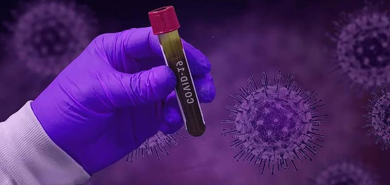 Esperto mondiale rivela Stop del coronavirus alla fine del 2021