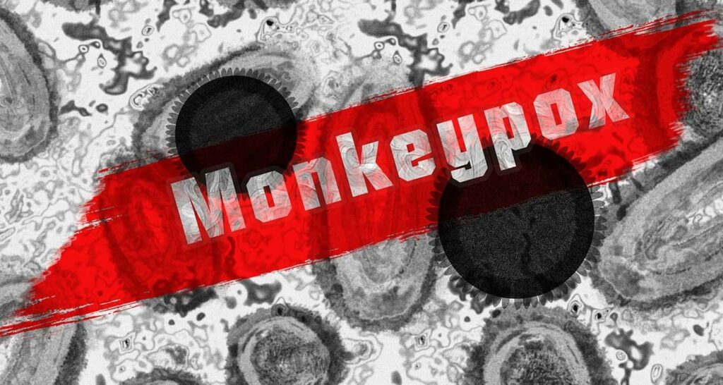 Monkeypox il vaiolo delle scimmie ha raggiunto 50 mutazioni