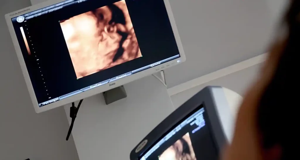 eta massima per il congelamento degli ovuli