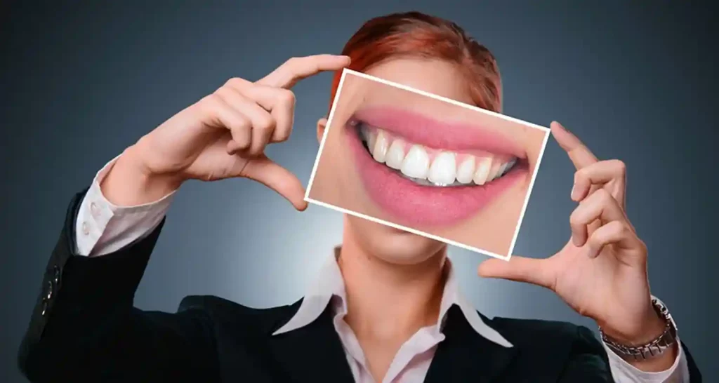 Come le faccette dentali possono trasformare il tuo sorriso in poche ore