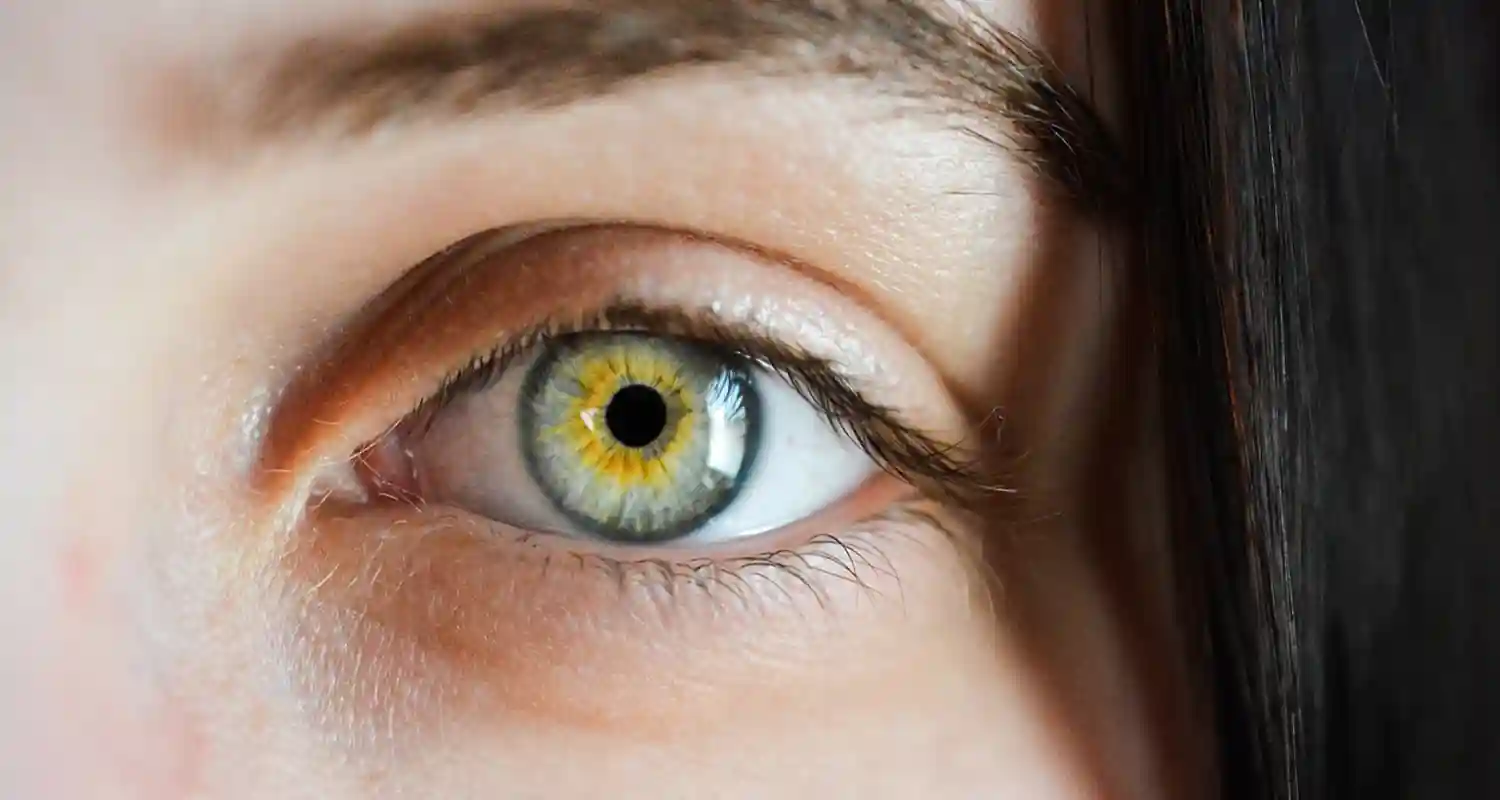 Il glaucoma secondario e la genetica cosa sappiamo finora